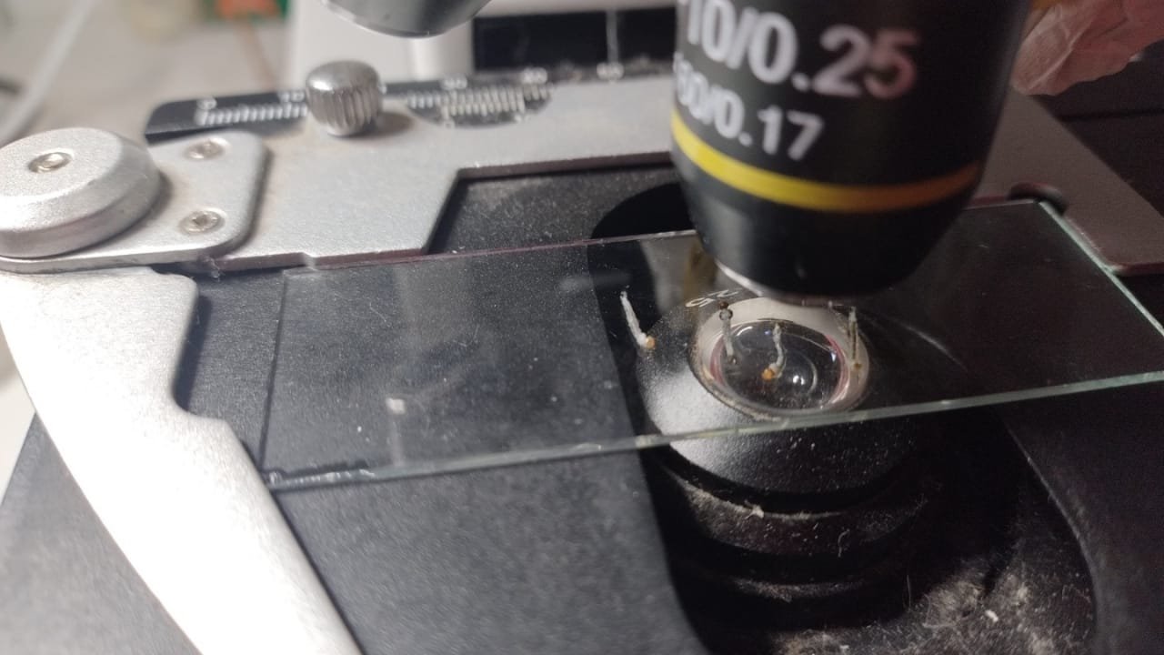 Porto Belo,dengue,LIRAa,Aedes Aegypti,prevenção,Zika Vírus,Chikungunya,Vigilância Epidemiológica,Santa Luzia,Perequê,criadouros,água parada,DengueZap,saúde pública,Santa Catarina