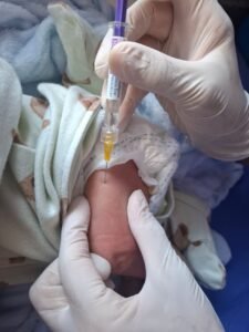 anticorpo VSR Balneário Camboriú,nirsevimabe SC,prevenção bronquiolite bebê,prevenção pneumonia infantil,prematuros imunização,Hospital Regional Ruth Cardoso UTI Neonatal,Ministério da Saúde VSR,doses nirsevimabe Santa Catarina,comorbidades elegíveis VSR,saúde pública BC,Vigilância Epidemiológica BC,imunização antes do inverno,proteção respiratória infantil,vírus sincicial respiratório bebê,UBS Balneário Camboriú vacinação