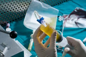 Fevereiro Laranja,diagnóstico precoce leucemia,cadastro REDOME,doação de medula óssea,transplante de medula óssea Brasil,leucemia sintomas,hemograma detecta leucemia,Univali Itajaí,Hemosc Santa Catarina,REDOME Brasil,tratamento leucemia aguda,câncer no sangue,medula óssea compatibilidade HLA,Governo de Santa Catarina saúde,doador de medula Itajaí